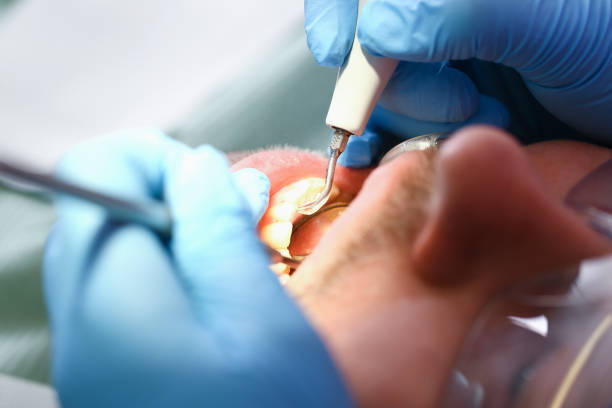 Emergency Gum Pain Relief in OR
